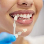 Woman Comparing Dental Veneer Shades For Cosmetic Smile Enhancement Treatment