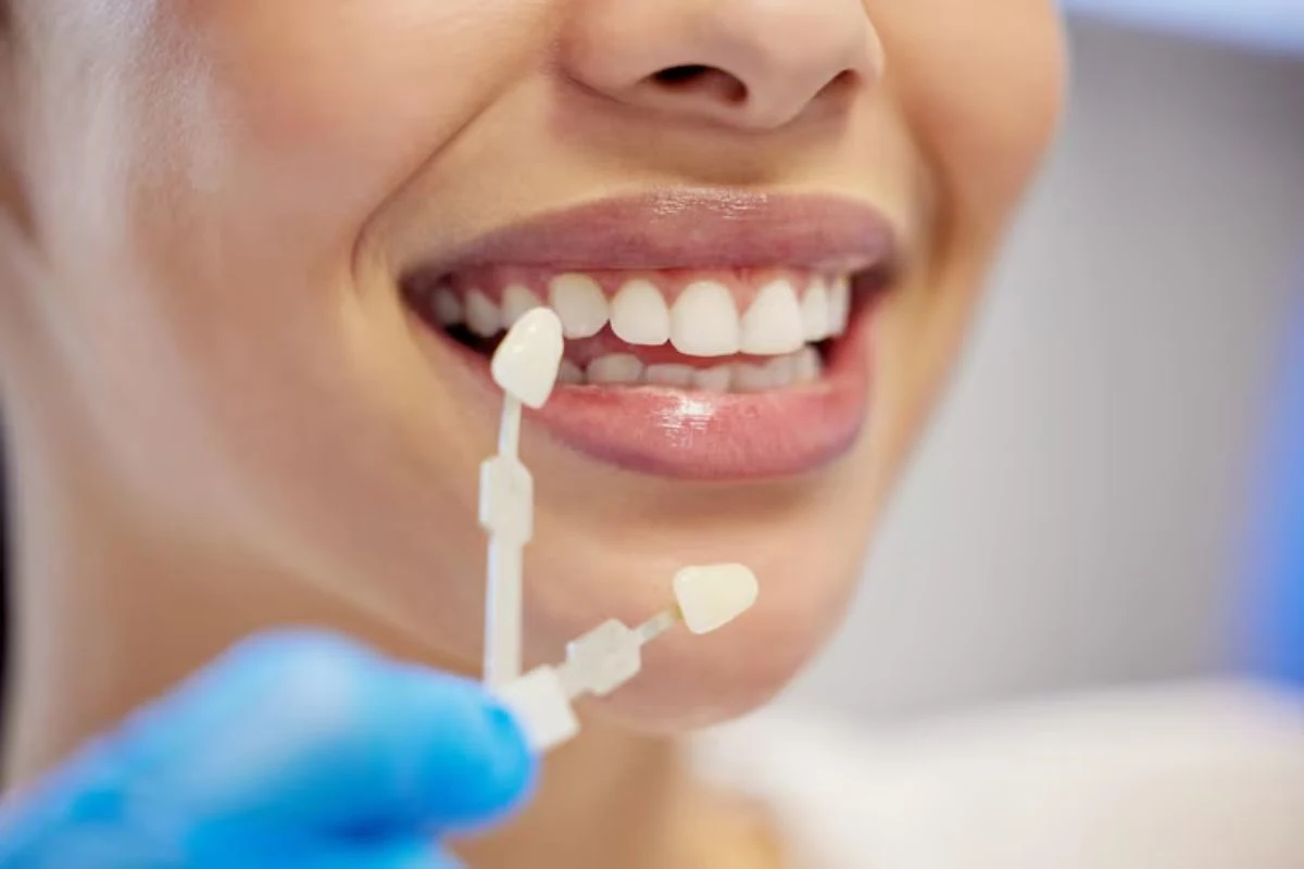 Woman Comparing Dental Veneer Shades For Cosmetic Smile Enhancement Treatment